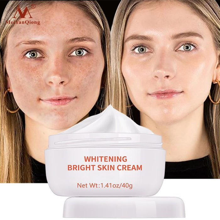 Whitening Freckle Cream for Dark Spot